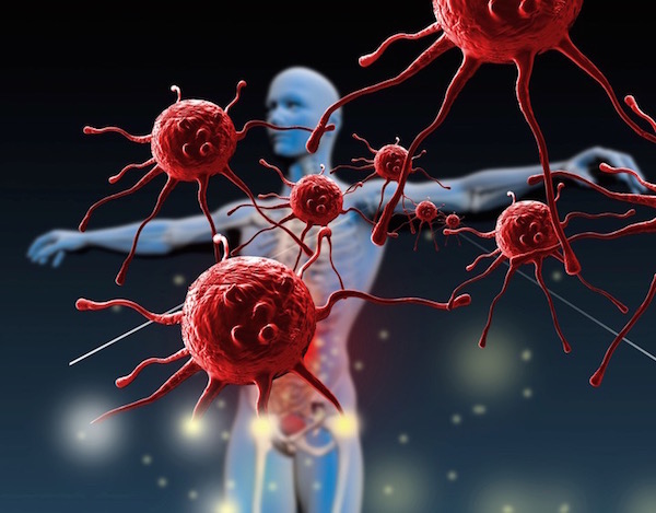 Immunrendszert szimbolizáló kép egy emberi testtel és a beférkőzni akaró baktériumokkal.