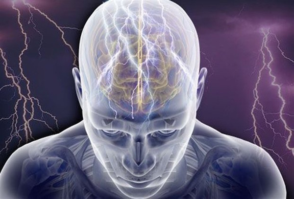 Elektromos aktivitás az agy egyes területein, epilepsziás roham.