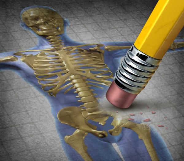 Egy emberi csontváz csípőjét radírozzák le egy emblematikus rajzon egy rózsaszín radírral ellátott ceruza végével, utalva ezzel a csontritkulásra.