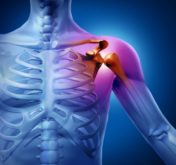 ízületi fájdalom a vállon mint kenet milyen gyógyszerek segítik a nyaki osteochondrozist