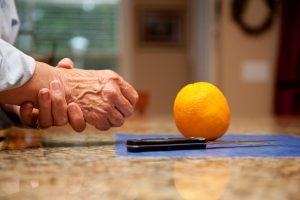Az asztalon narancs és kés, mellette egy idős női kéz csuklóját fájlalja, valószínűleg artrózisa van.