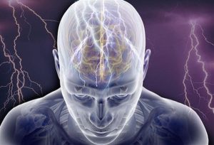 Elektromos aktivitás az agy egyes területein, epilepsziás roham.