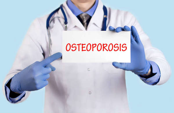 Osteoporosis feliratú táblát mutat kezében egy kék gumikesztyűt viselő orvos.