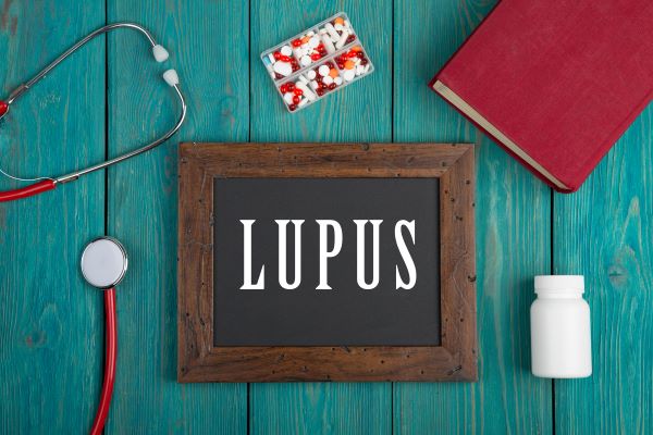 Türkiz színű deszkaasztalon fakeretes fekete tábla "LUPUS" felirattal, körülötte sztetoszkóp, gyógyszeradagoló doboz tele pirulákkal, vaskos könyv, gyógyszeres doboz.