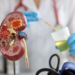 Előtérben egy orvosi vesemodell, háttérben fehér köpenyes alak vizeletvizsgálatot végez.